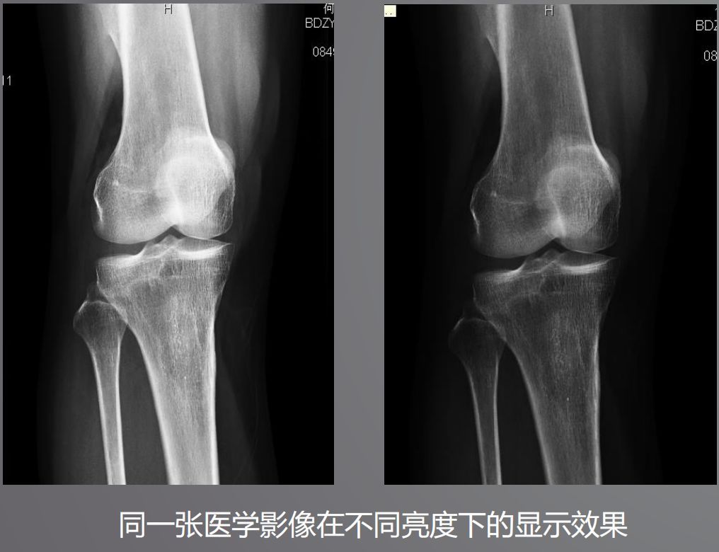 寵物DR設備的顯示器有要求？普通和醫用顯示器有什么區別